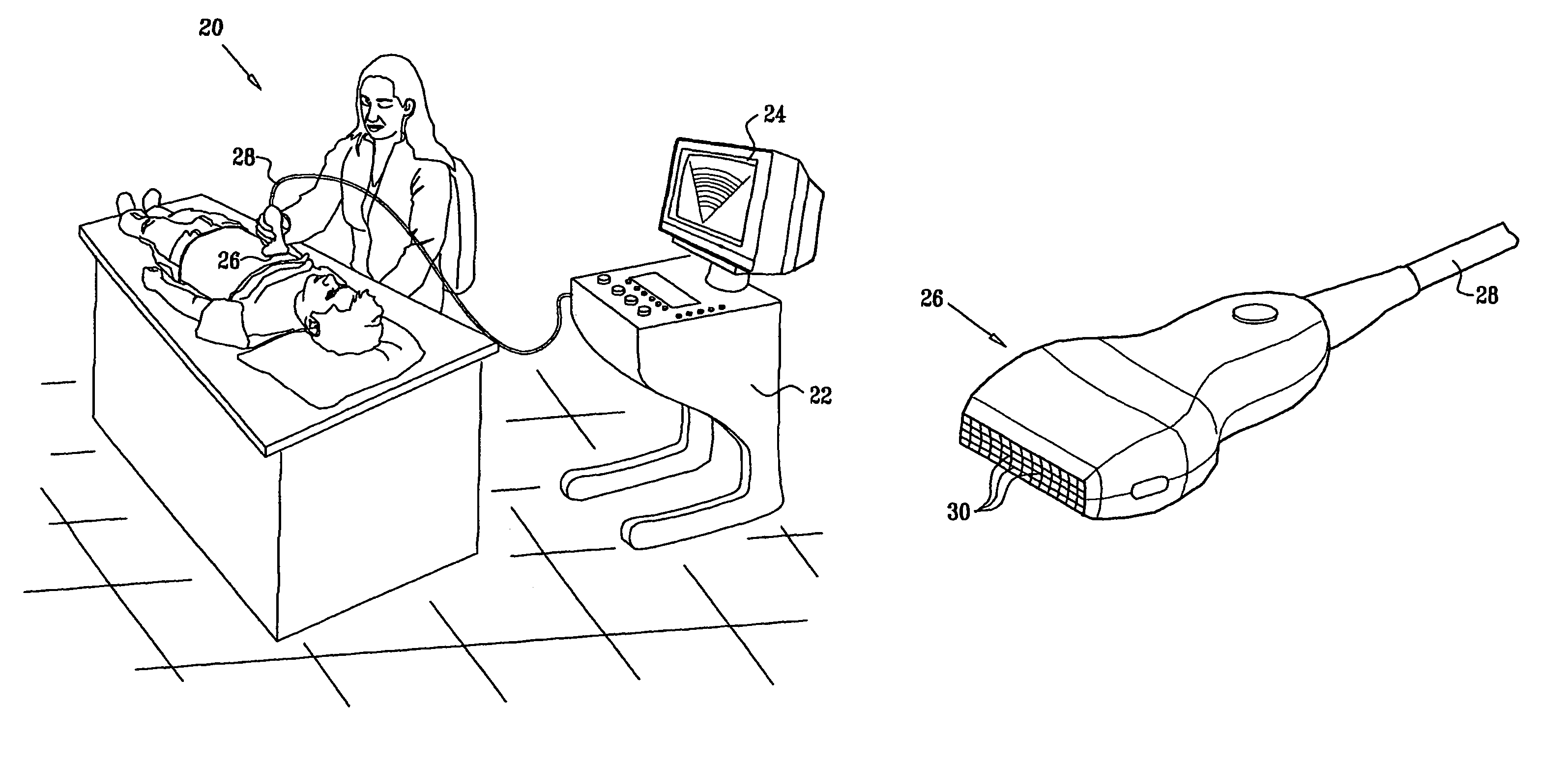 Clutter suppression in ultrasonic imaging systems