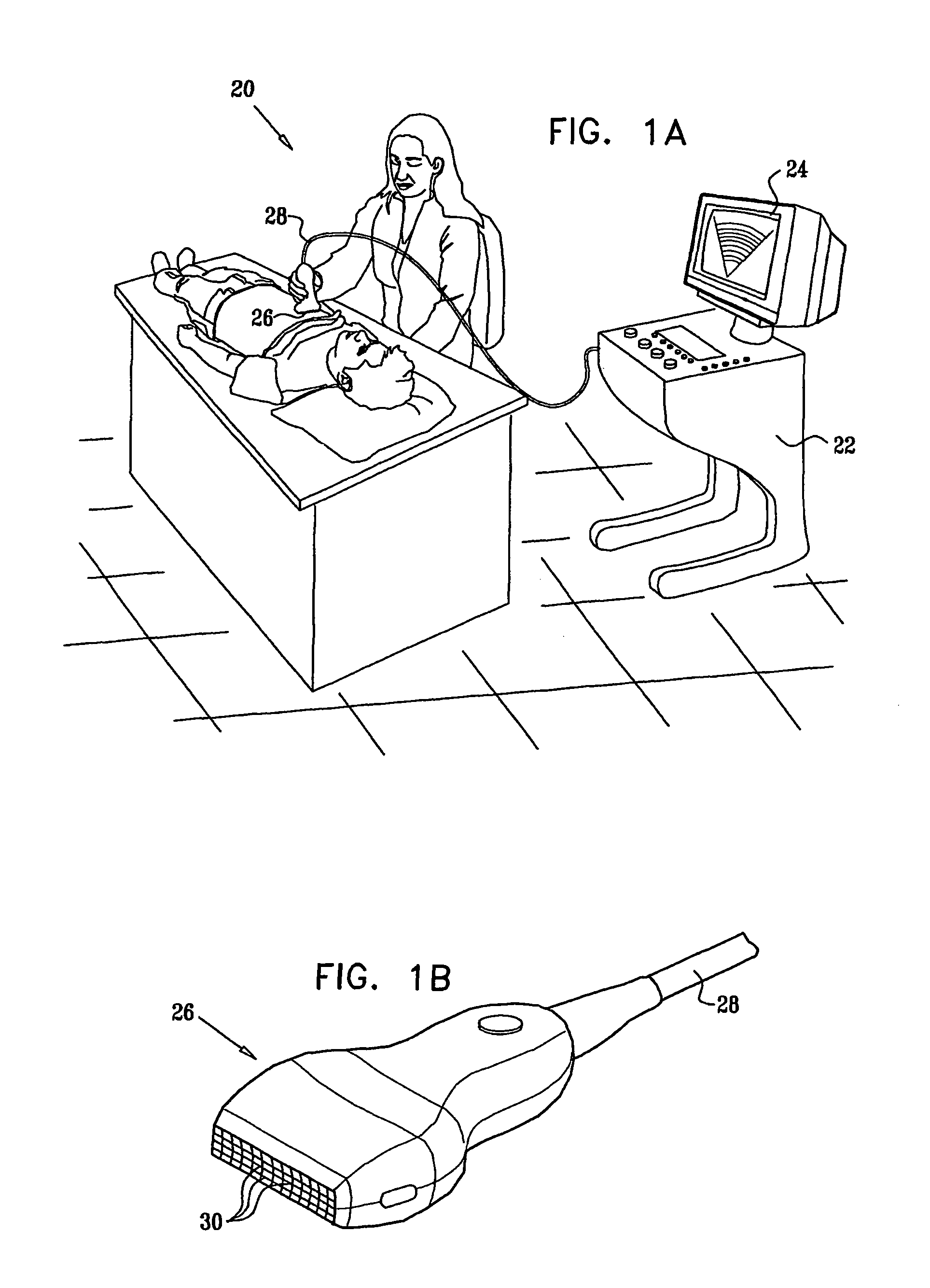 Clutter suppression in ultrasonic imaging systems