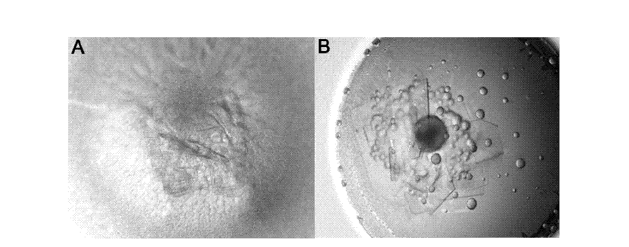 Expression and purification of amino terminal region of SARS coronavirus non-structural protein nsp2, and crystalline structure of amino terminal region