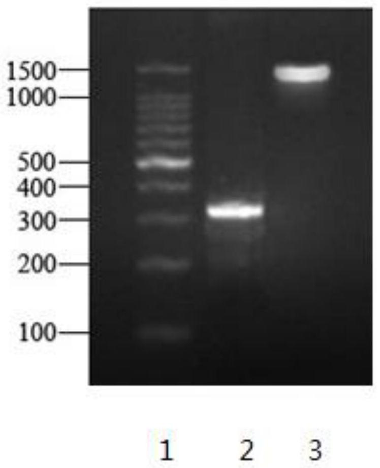 A strain of Lactobacillus plantarum for biological acid reduction with high production of volatile esters and its application in fruit wine