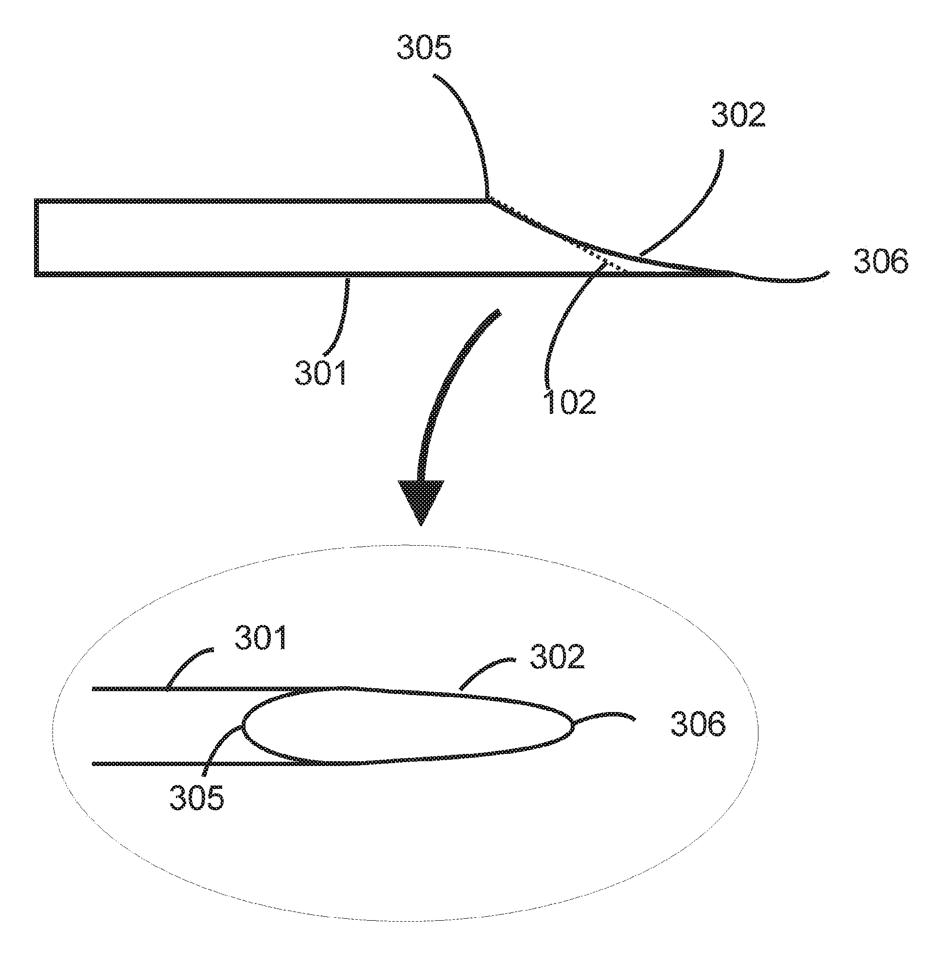 Sharp trochar for insertion of a cannula in vitrectomy surgery