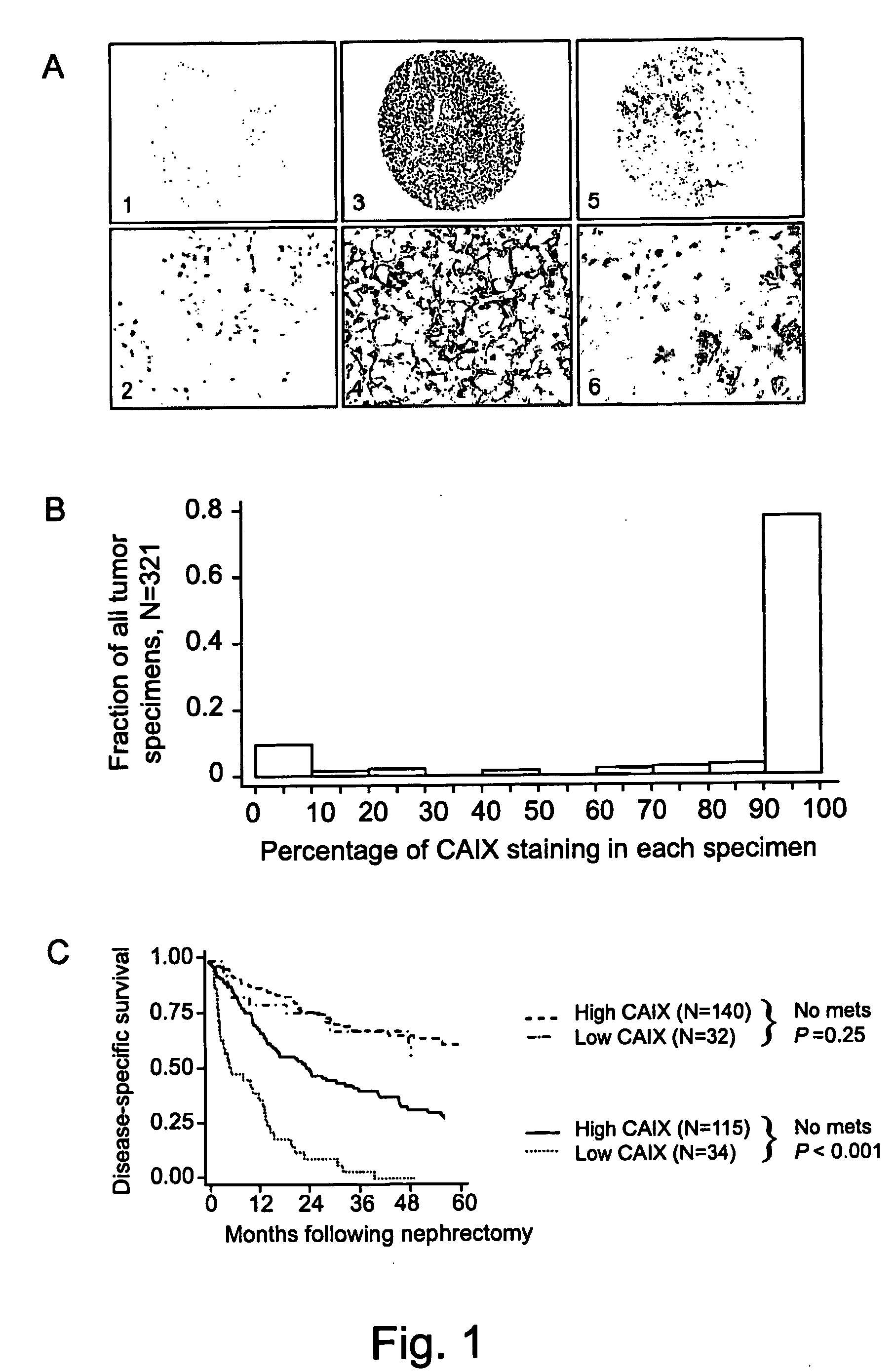 Methods of renal cell carcinoma prognosis and treatment selection with carbonic anhydrase IX