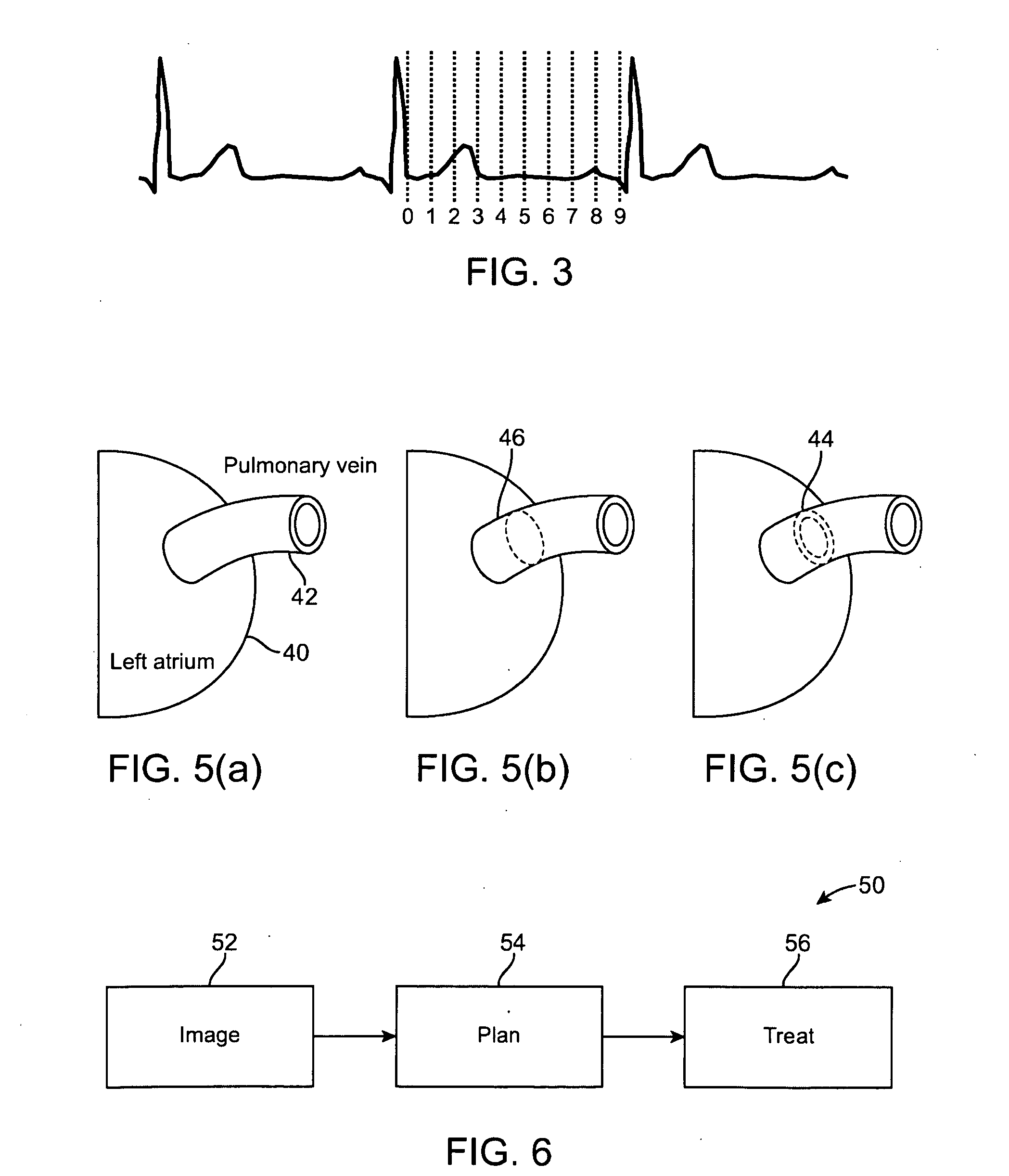 Radiation treatment planning and delivery for moving targets in the heart