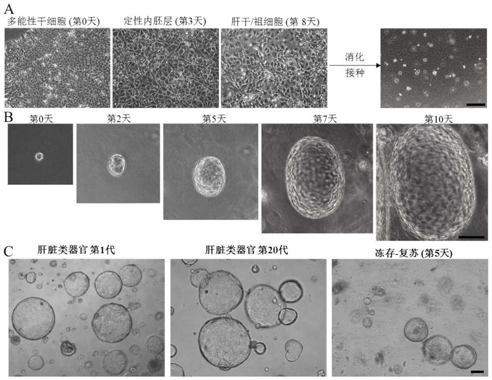 Method for establishing an in vitro simulated liver disease model and its special three-dimensional medium