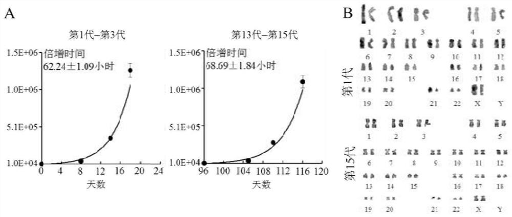 Method for establishing an in vitro simulated liver disease model and its special three-dimensional medium