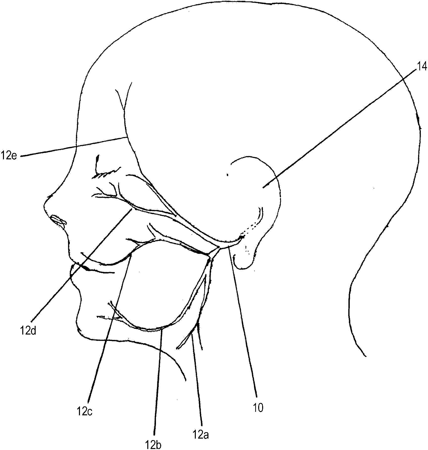 Facial stimulation apparatus