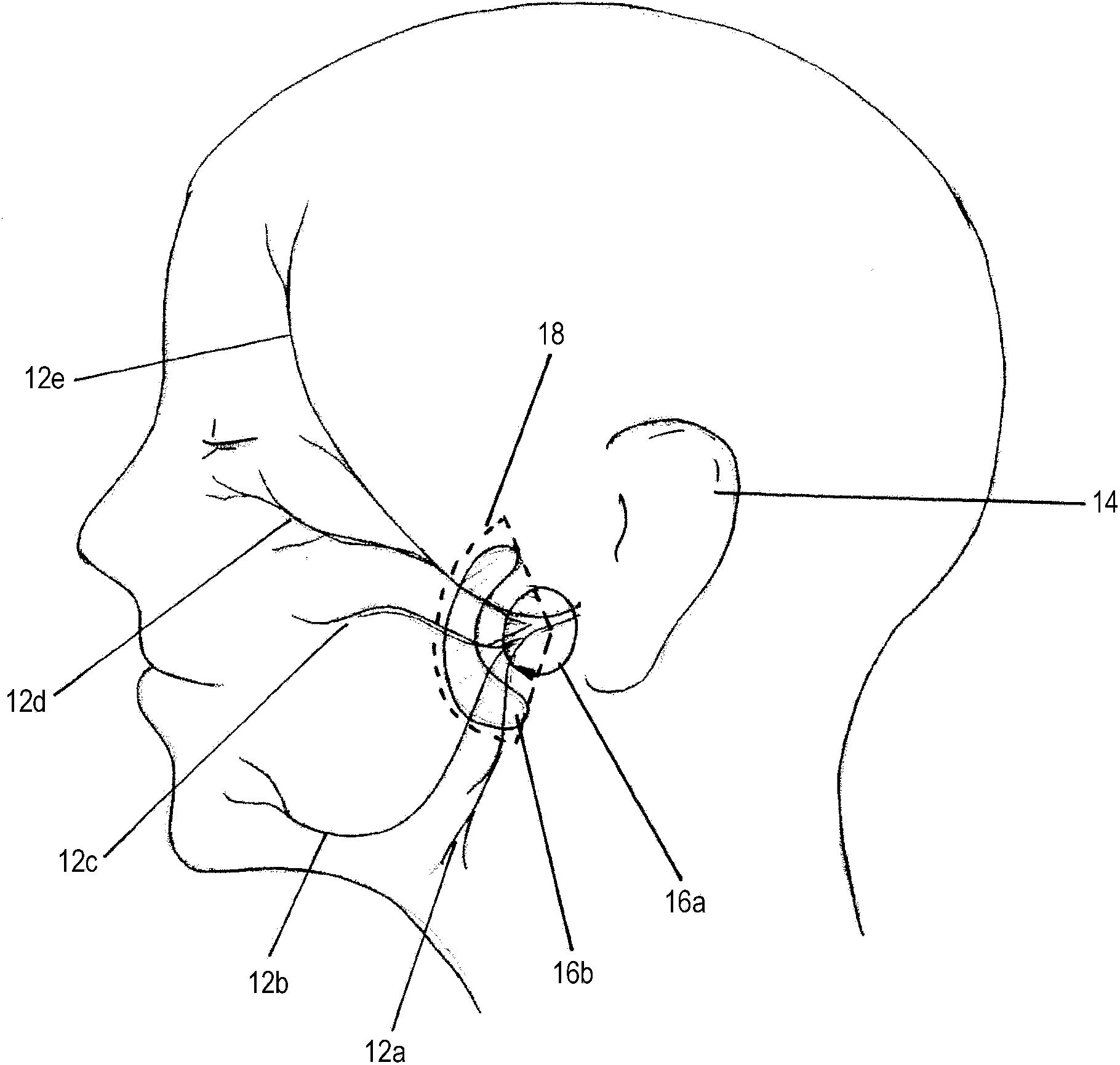 Facial stimulation apparatus