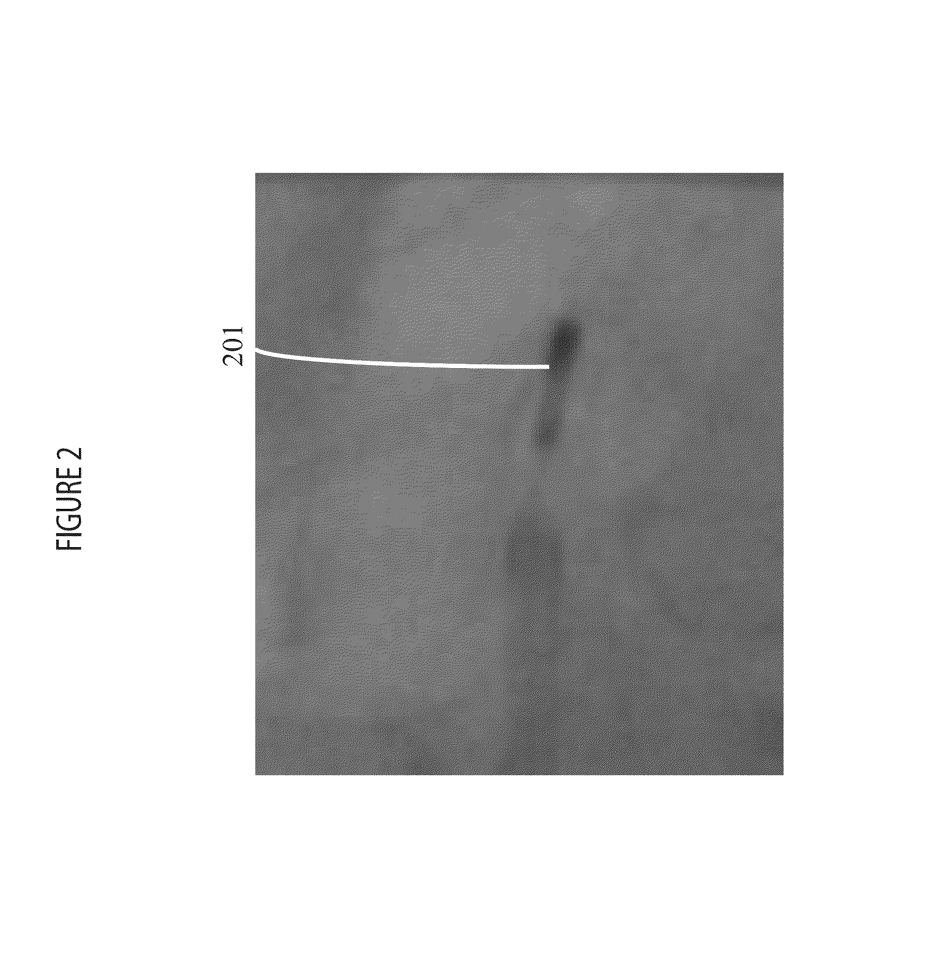 System for detecting rotation angle of a catheter in an X-ray image