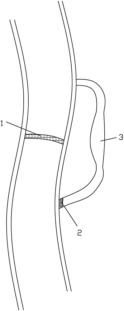 Self-circulation type urban central park water treating system and method