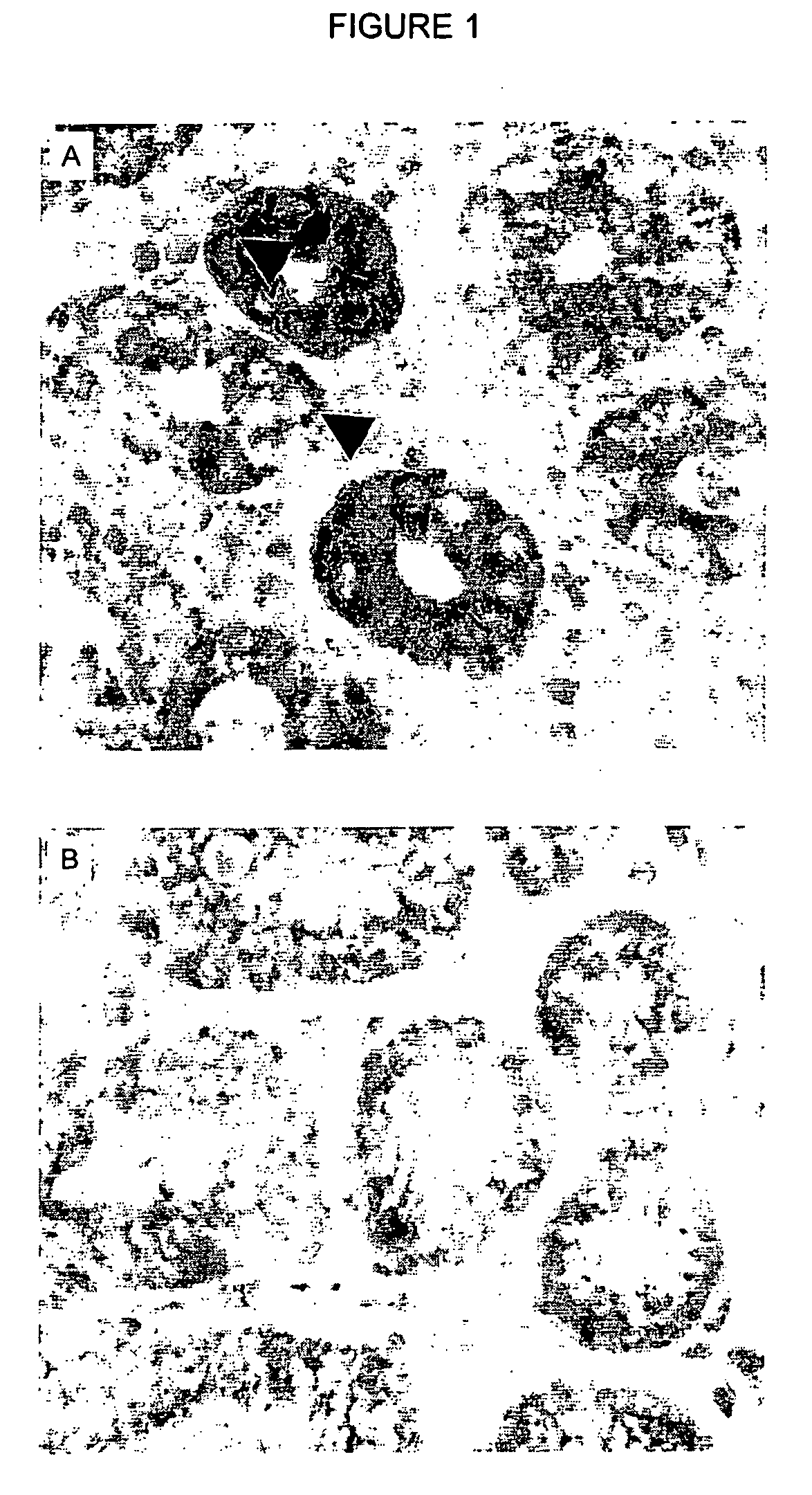 Laminin-5 modulators and uses thereof