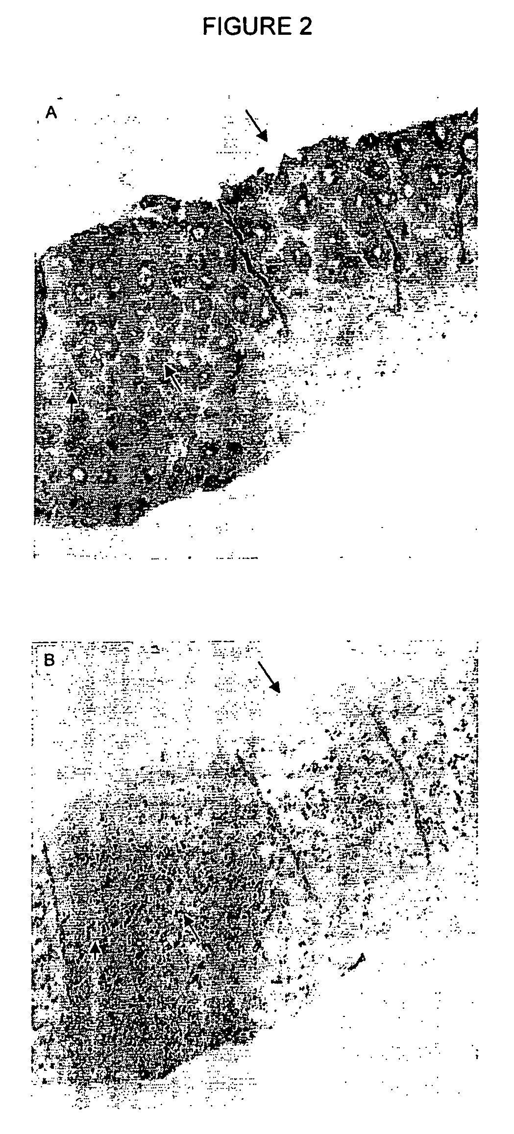 Laminin-5 modulators and uses thereof