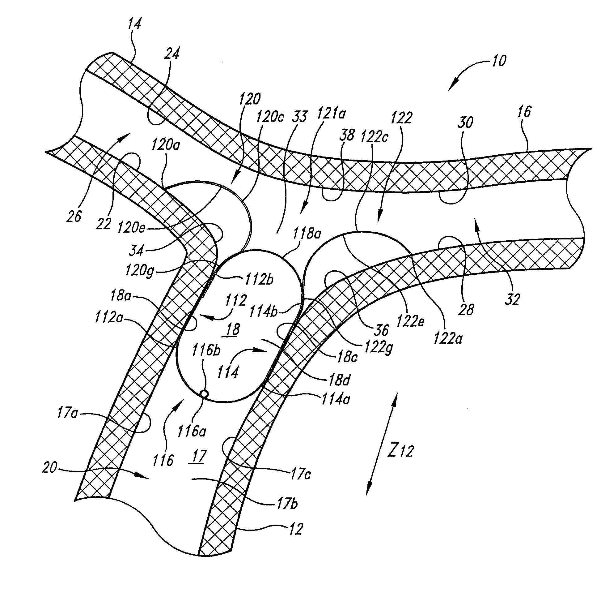 Vascular anchoring system and method