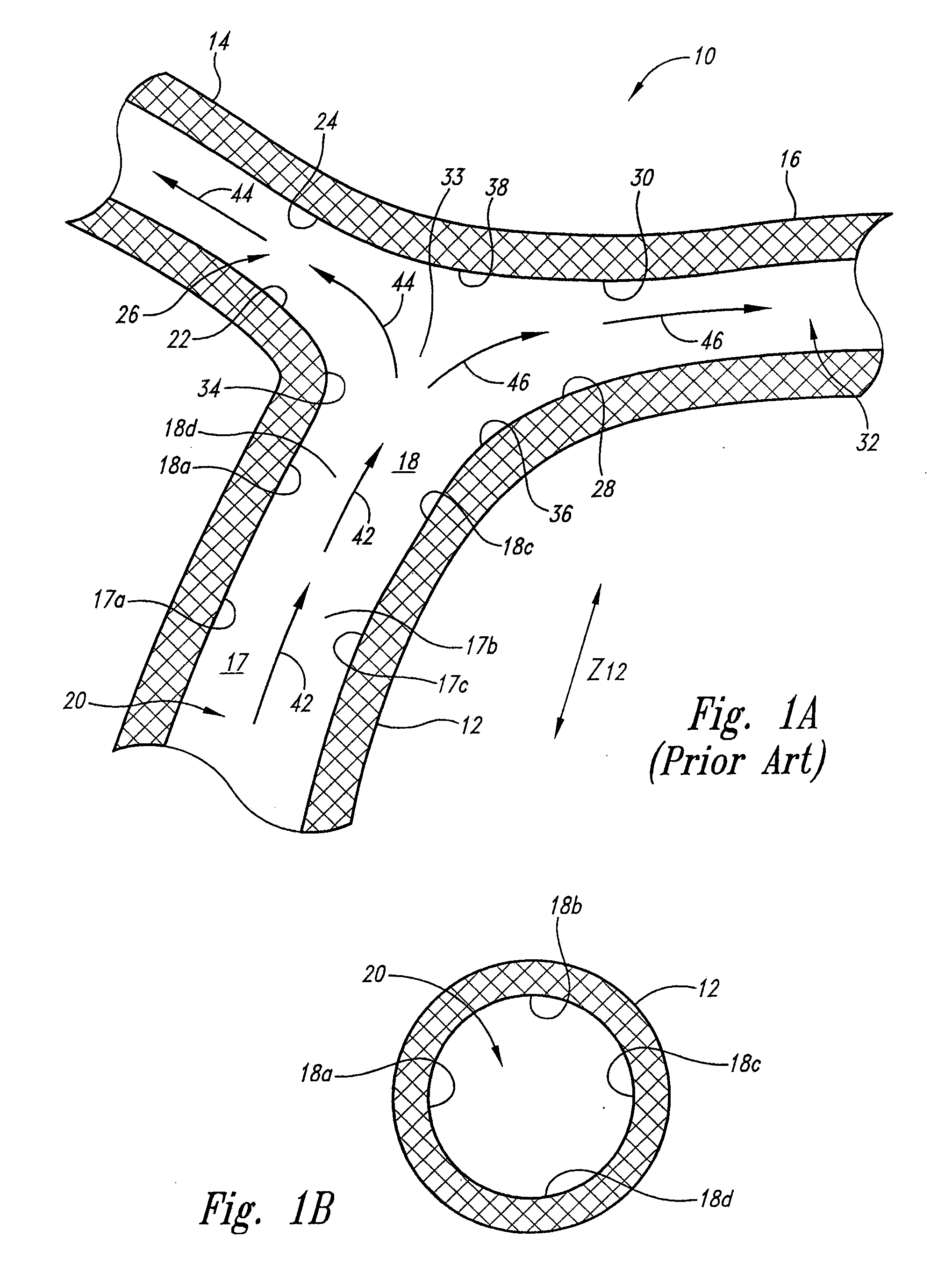 Vascular anchoring system and method