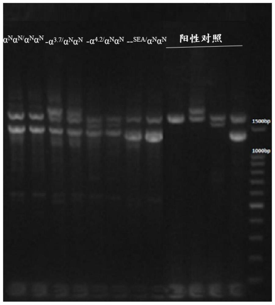 A kit for detecting thalassemia gene mutation