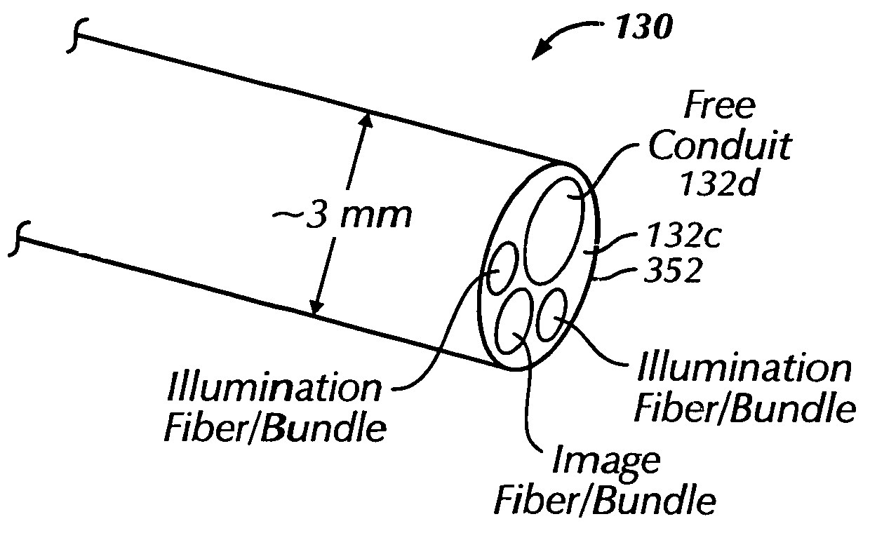 Ophthalmic orbital surgery apparatus and method and image-guide navigation system