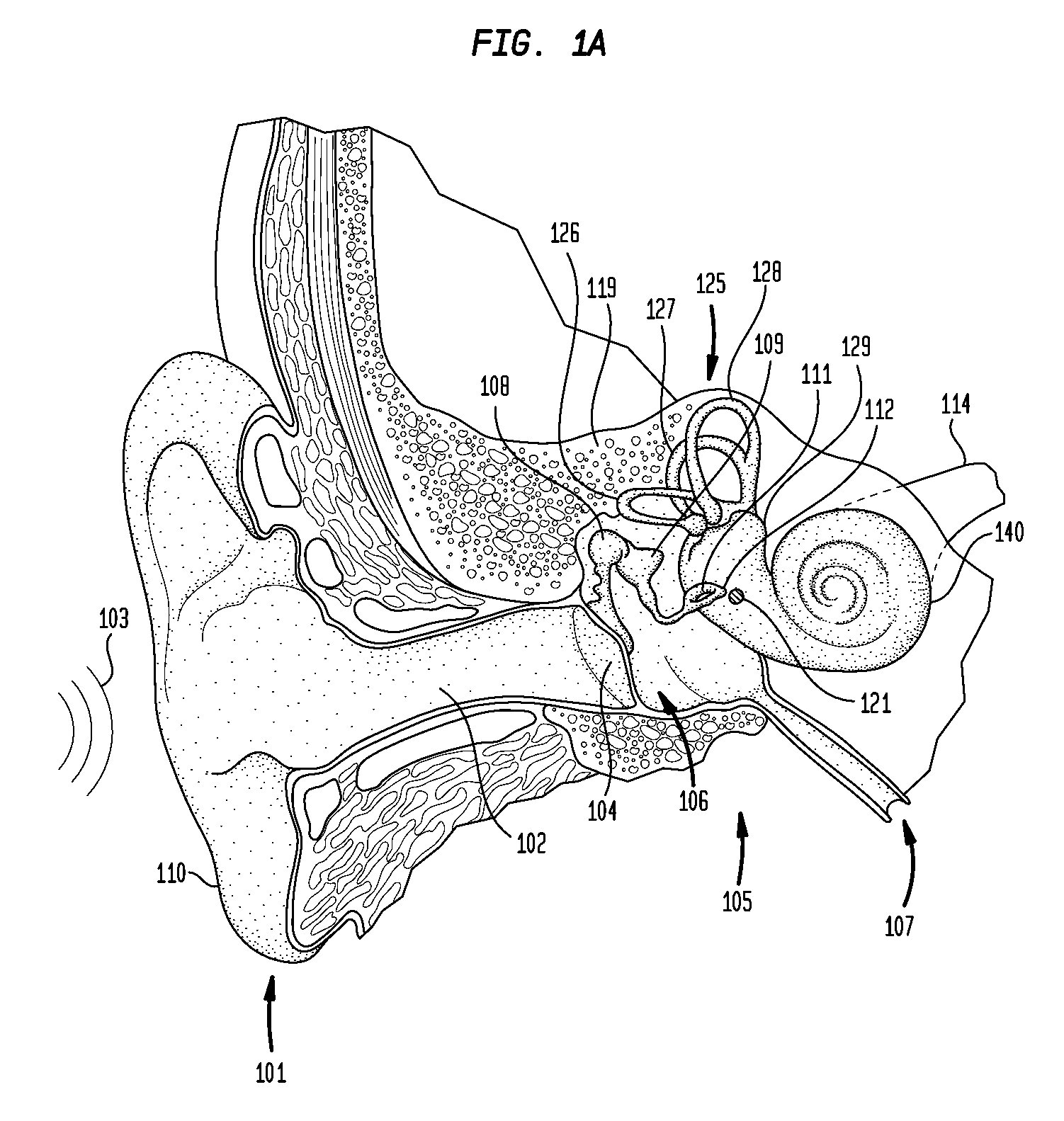 Direct acoustic cochlear stimulator for round window access