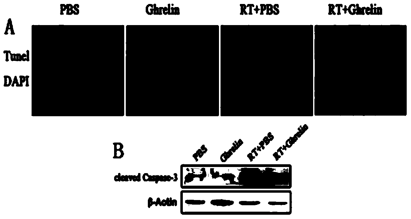 Application of ghrelin in prevention or/and treatment of radiation-induced lung injury