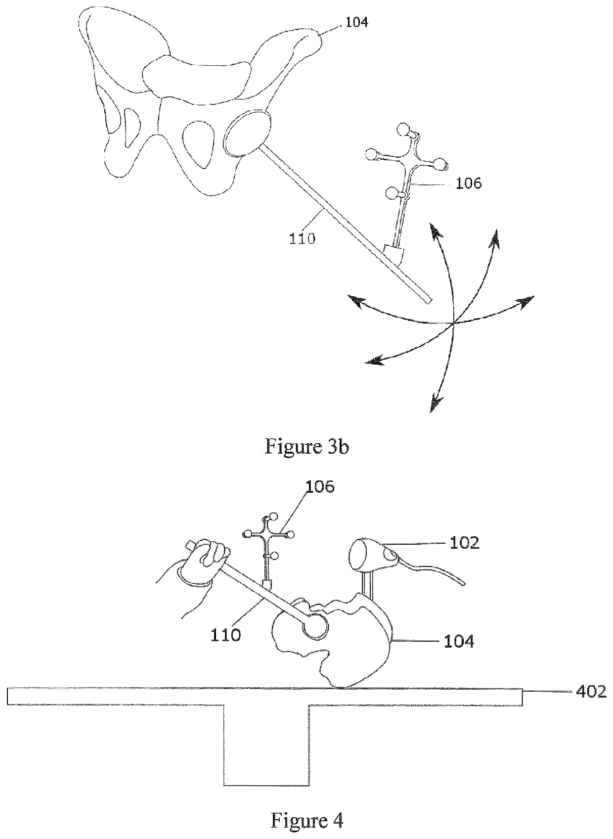 Systems, methods and devices for calculating hip center of rotation, adjusting parameters of joint replacement for pelvic tilt and calculating leg length and offset