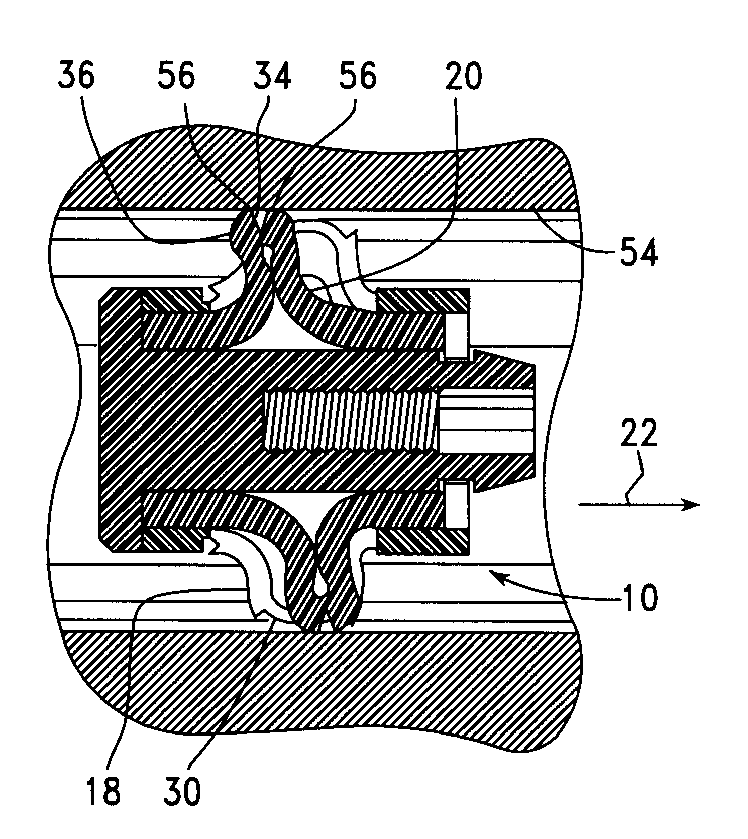 Device and method for plugging a bone channel with an expandable medullary plug