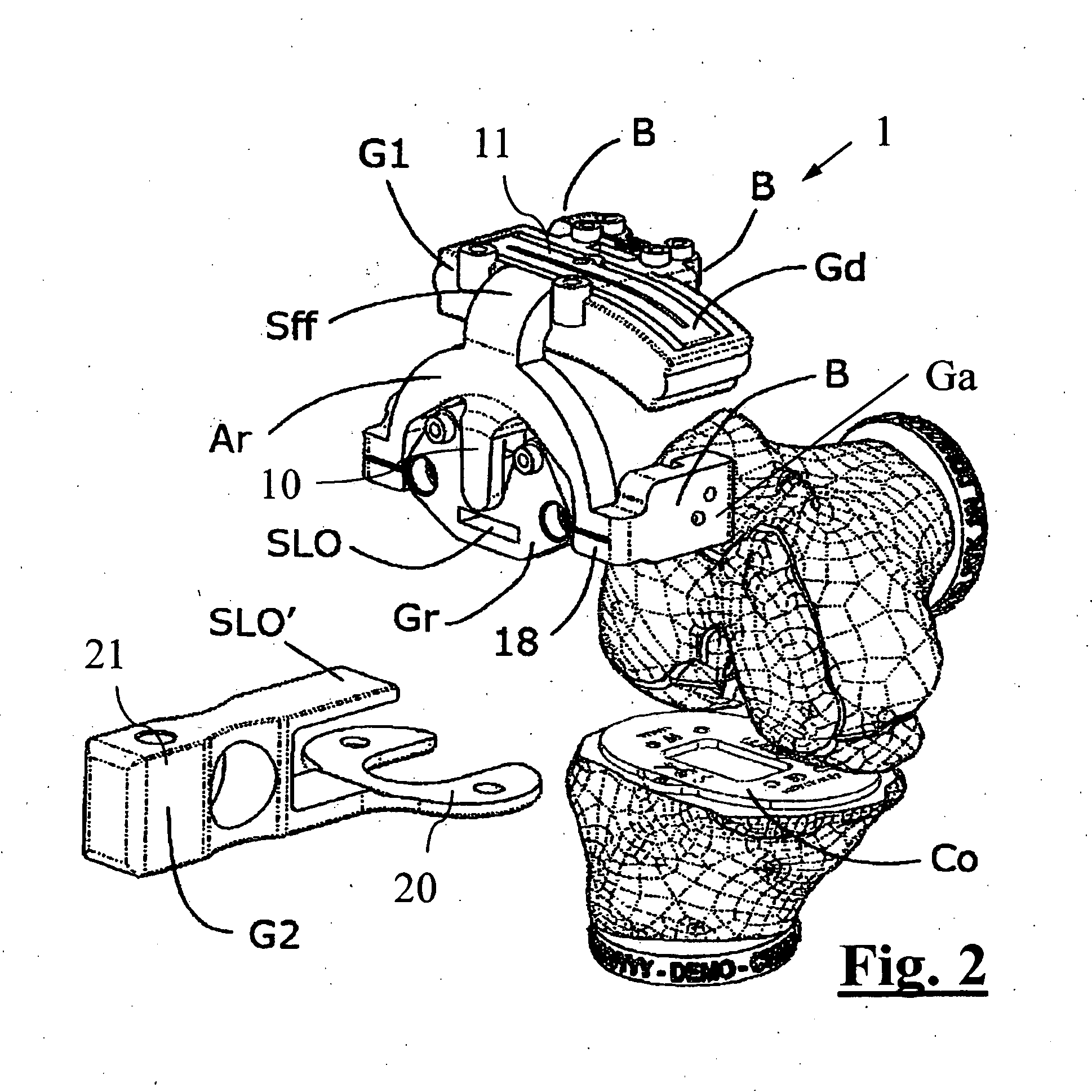 Surgical guide for implanting a knee prosthesis