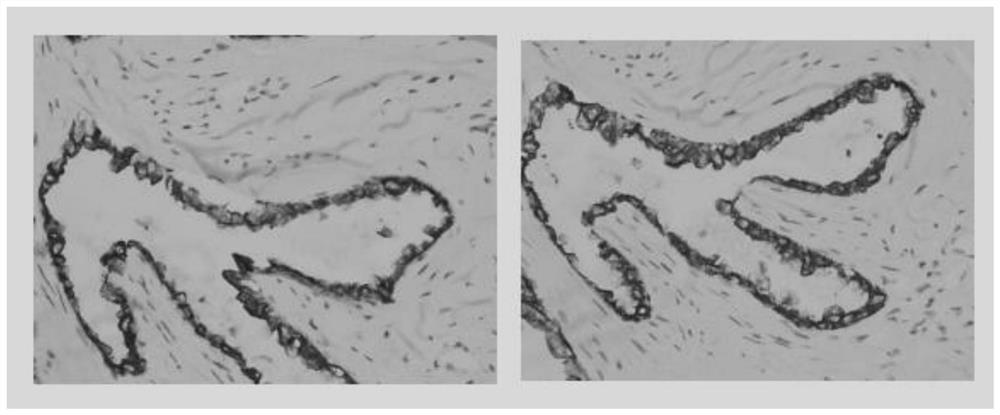 Monoclonal antibody against CK8 protein and cell strain, preparation method and application thereof