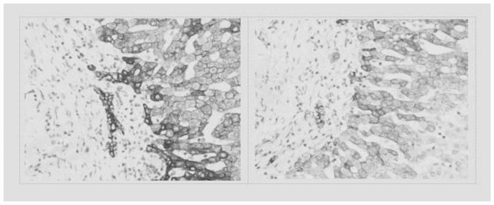 Monoclonal antibody against CK8 protein and cell strain, preparation method and application thereof