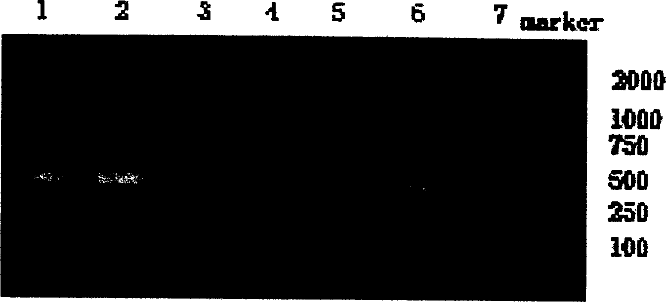 Soybean phytophthora testing reagent kit and its test method