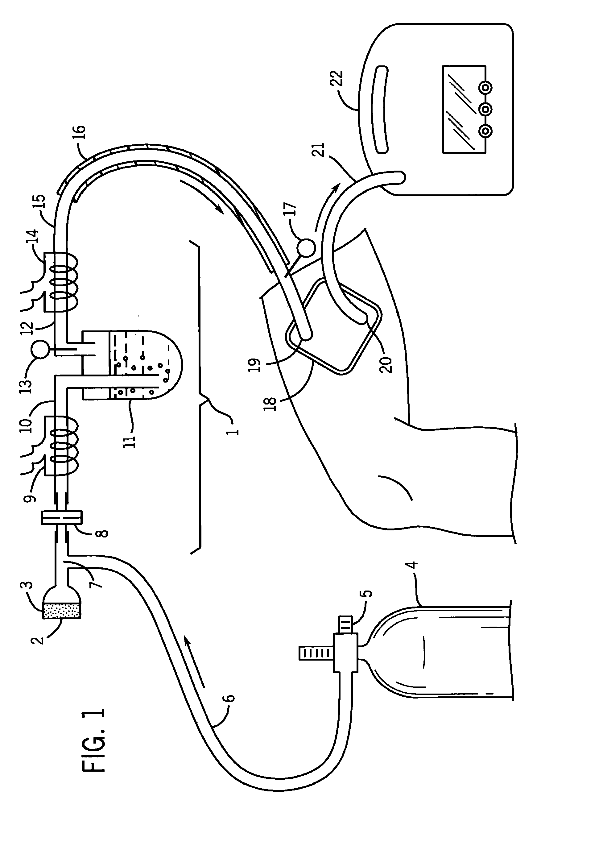 Wound Ventilation System