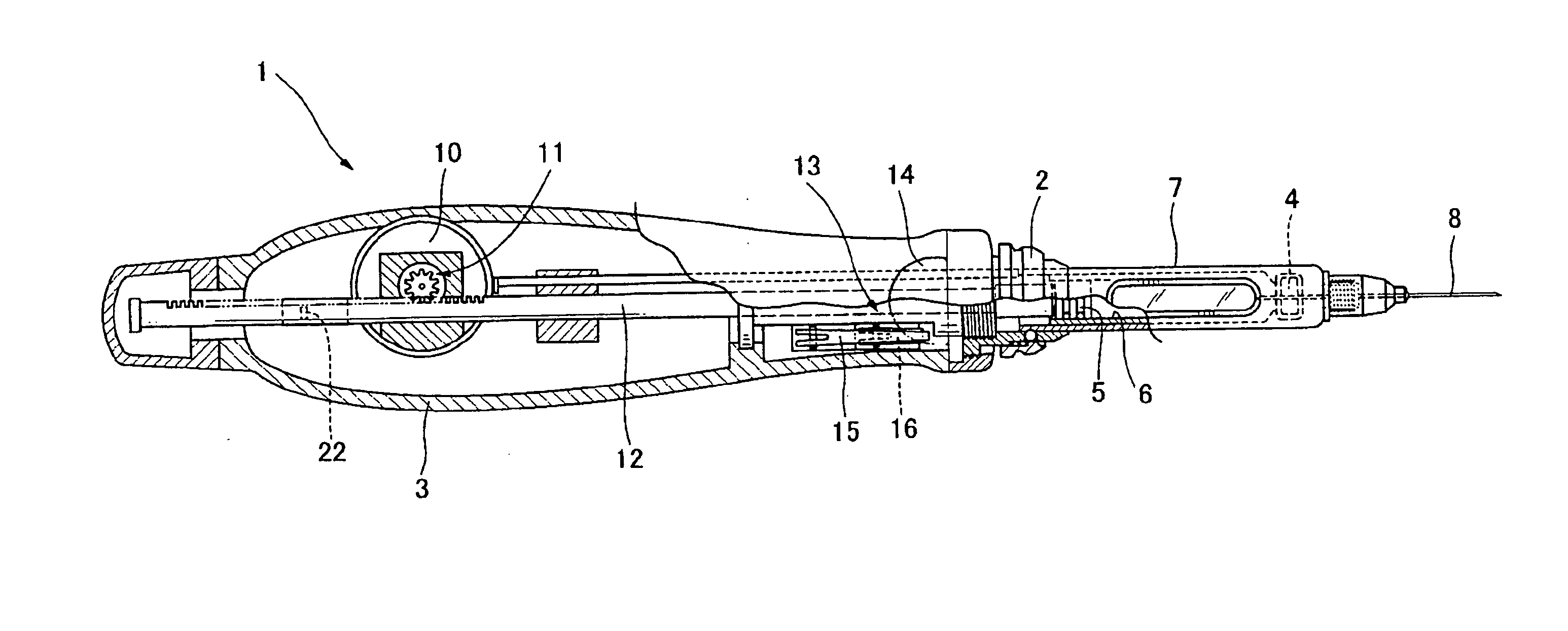 Method and apparatus for controlling the injection rate of a drug solution in a cartridge type motor-driven dental injection syringe