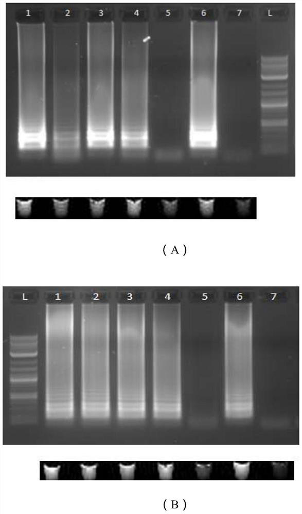 Primers for detecting SARS-CoV-2 novel coronavirus and kit thereof, detection method and applications