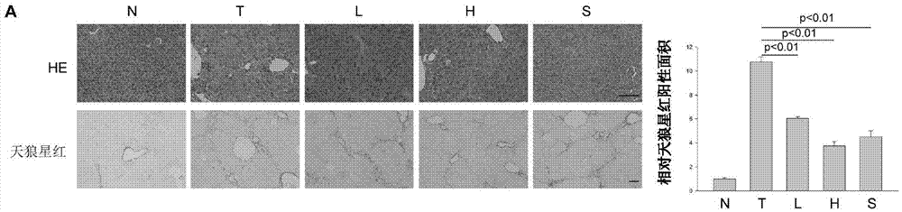 Application of O-GlcNAc glycosylation modification in preventing and treating hepatic fibrosis