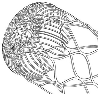 A Self-screening Thrombectomy Stent with Strong Capturing Power