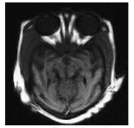 Computed tomography (CT) image and magnetic resonance (MR) image fusion method