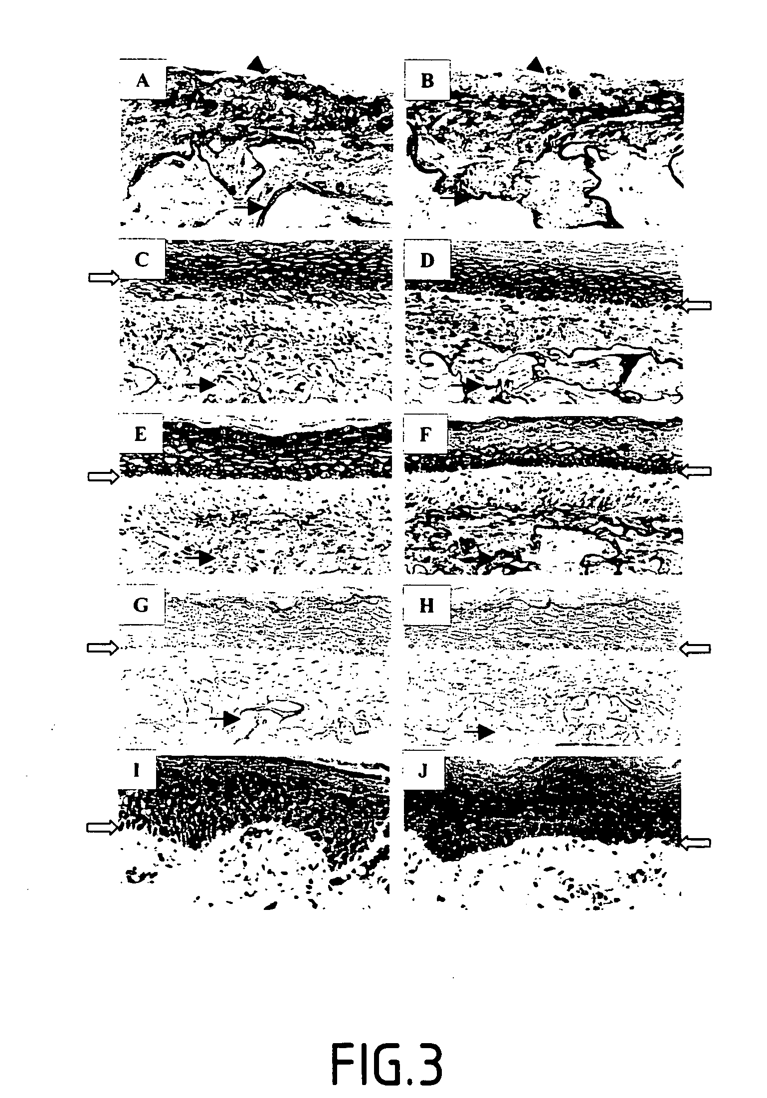 Stimulation of the activity of an isoform of lysyl oxidase for combating against some pathologies due to an incomplete, absent or disorganized elastogenesis