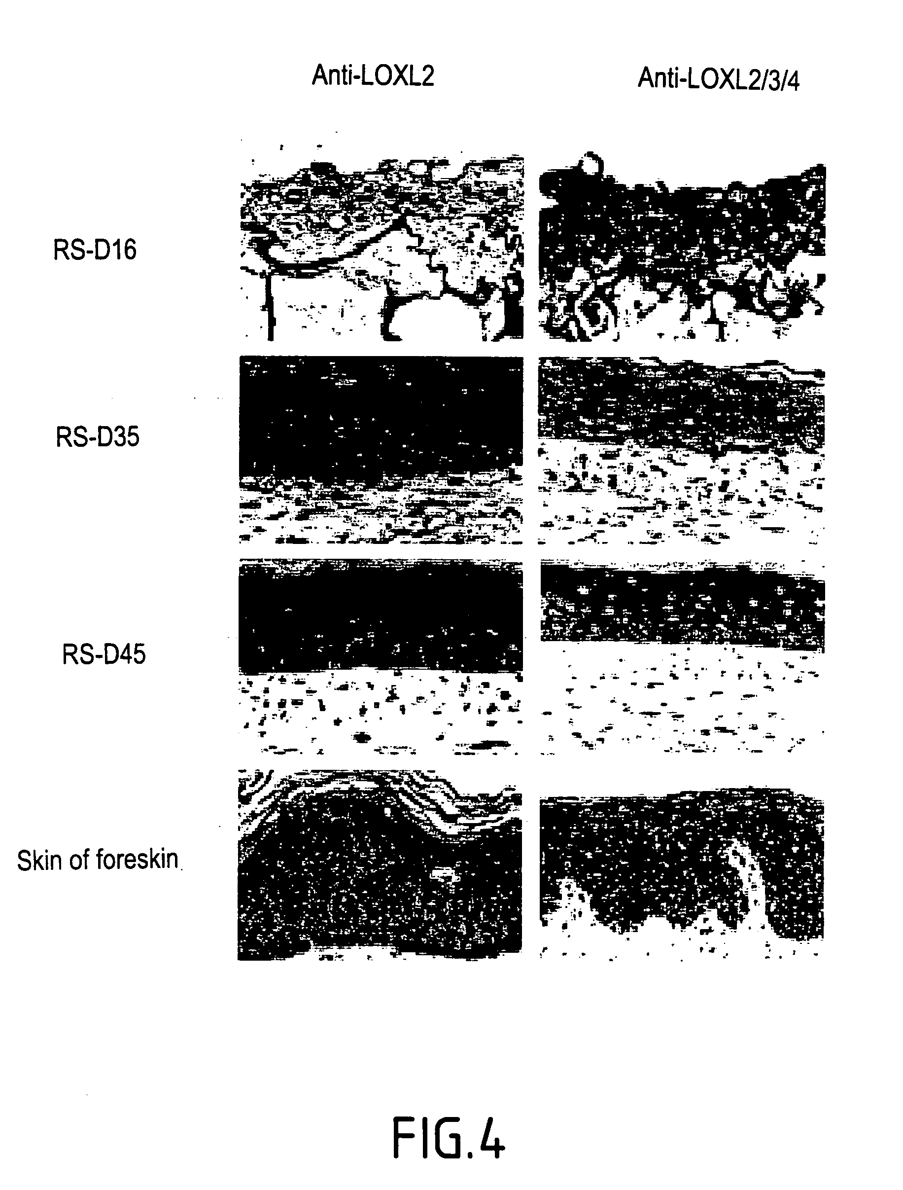 Stimulation of the activity of an isoform of lysyl oxidase for combating against some pathologies due to an incomplete, absent or disorganized elastogenesis