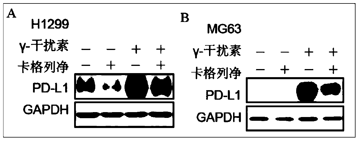 Application of canagliflozin in preparation of anti-tumor medicines