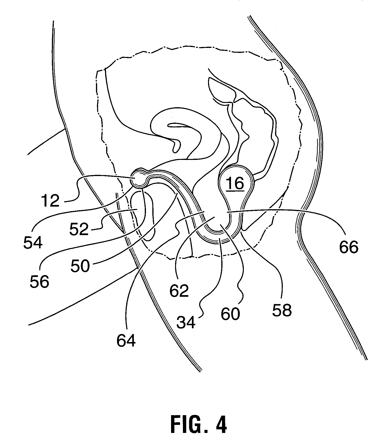 Kegel muscle exercising device and method for exercising Kegel muscle