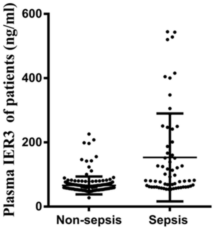 Application of IER3 as biomarker in early prediction of sepsis