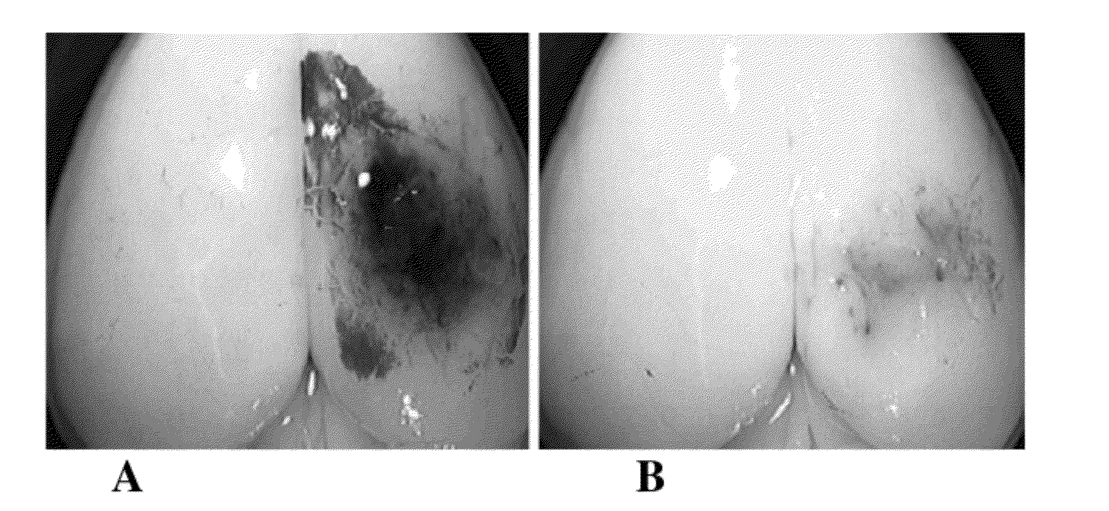 Methods of increasing neuronal differentiation using antibodies to lysophosphatidic acid