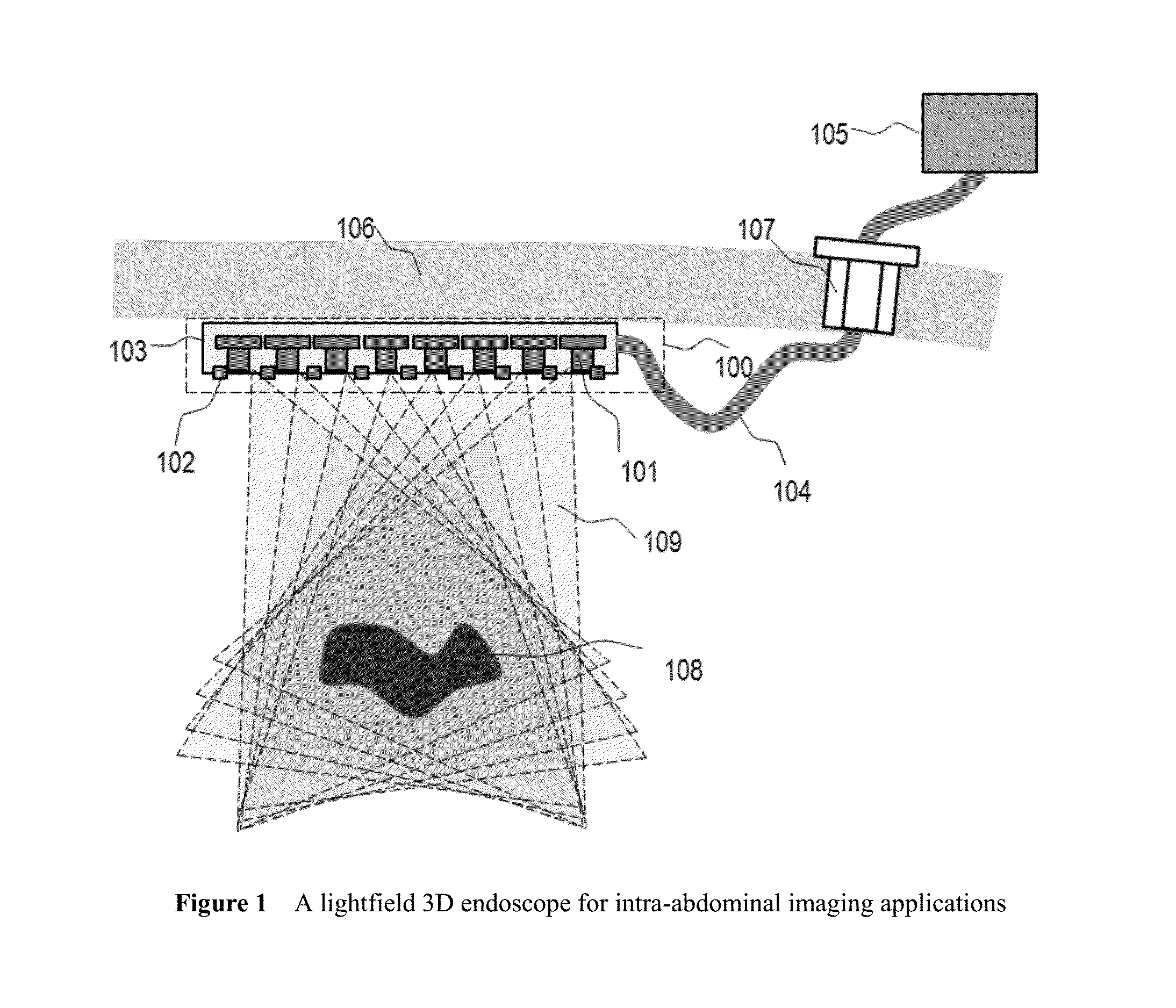 Intra- Abdominal Lightfield 3D Endoscope and Method of Making the Same