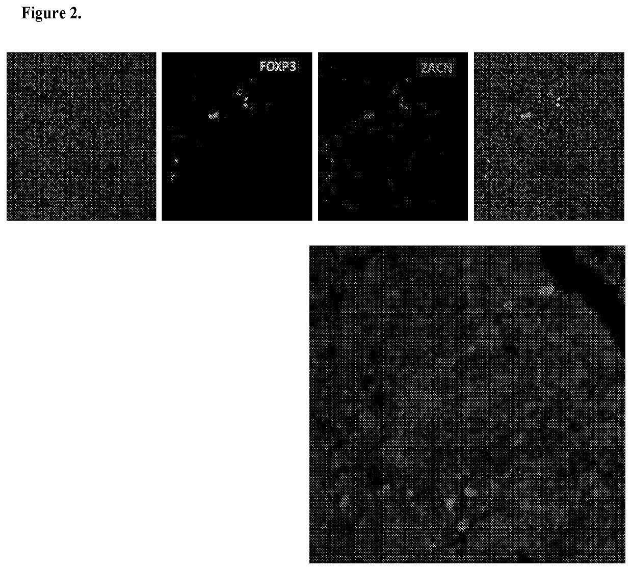 Modulators of zinc activated cation channel