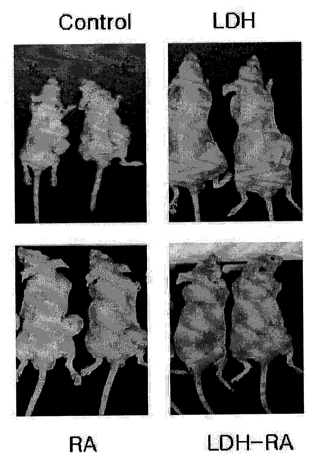 Pharmaceutical Composition for the Treatment of Cancer Comprising Lhm-Ra Complex