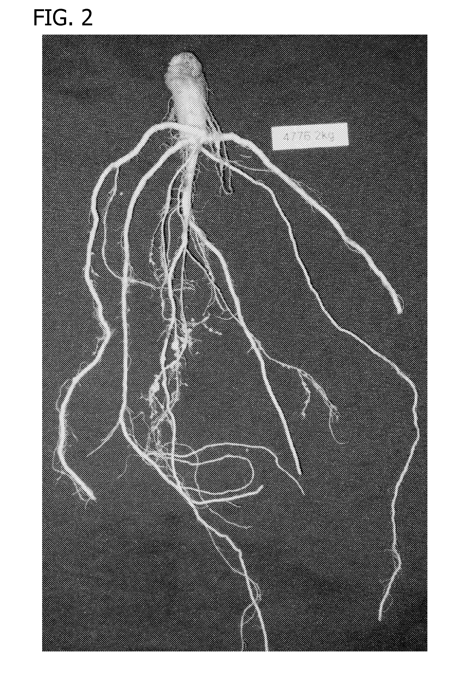 Compositions and methods for controlling nematodes