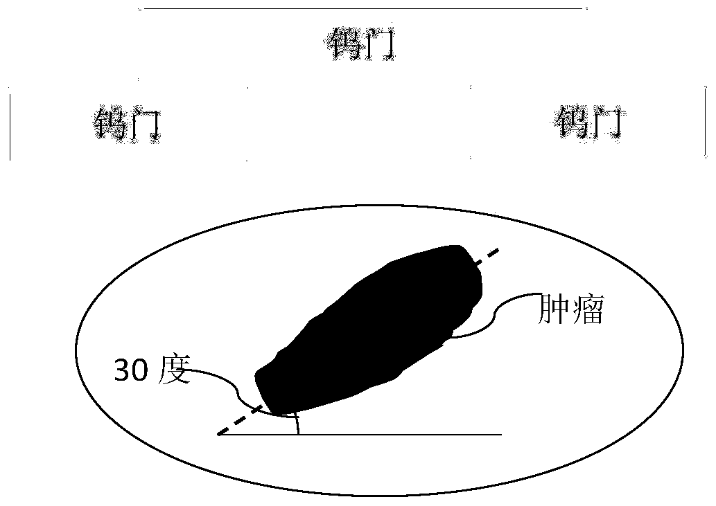 Method and device for generating dynamic wedge plate control points