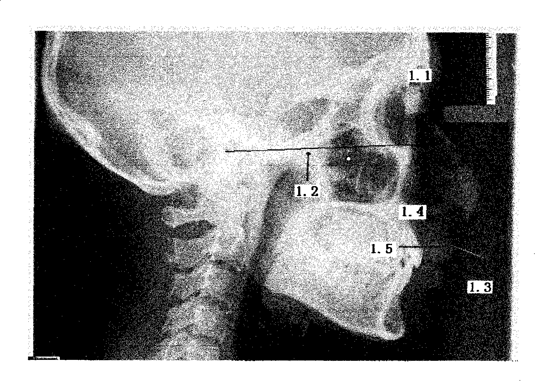 Method for measuring craniojaw skeleton. relationship and dimension