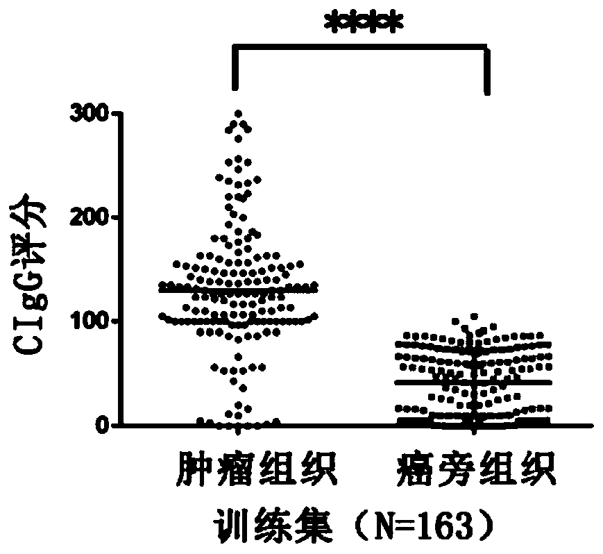 Application of tumor-derived IgG in diagnosis or prognosis of pancreatic cancer