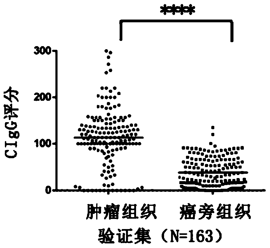 Application of tumor-derived IgG in diagnosis or prognosis of pancreatic cancer