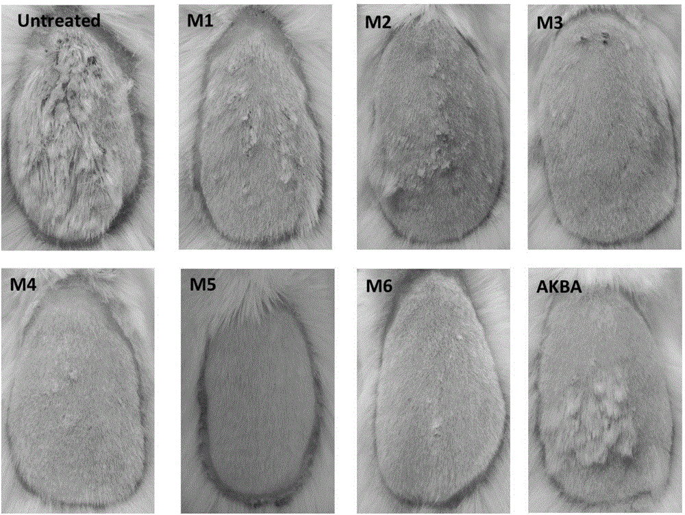 Preparation method and application of derivatives of pentacyclic triterpene structural compound