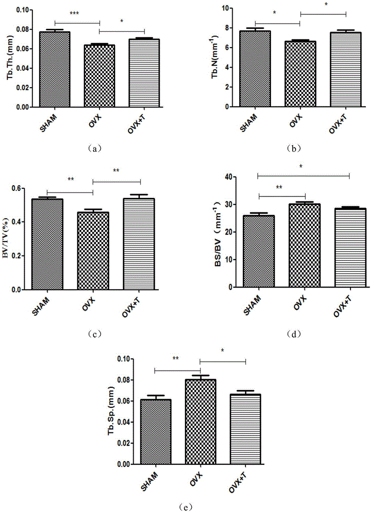 Application of peptide MDP-1 to preparing of anti-osteoporosis medicine