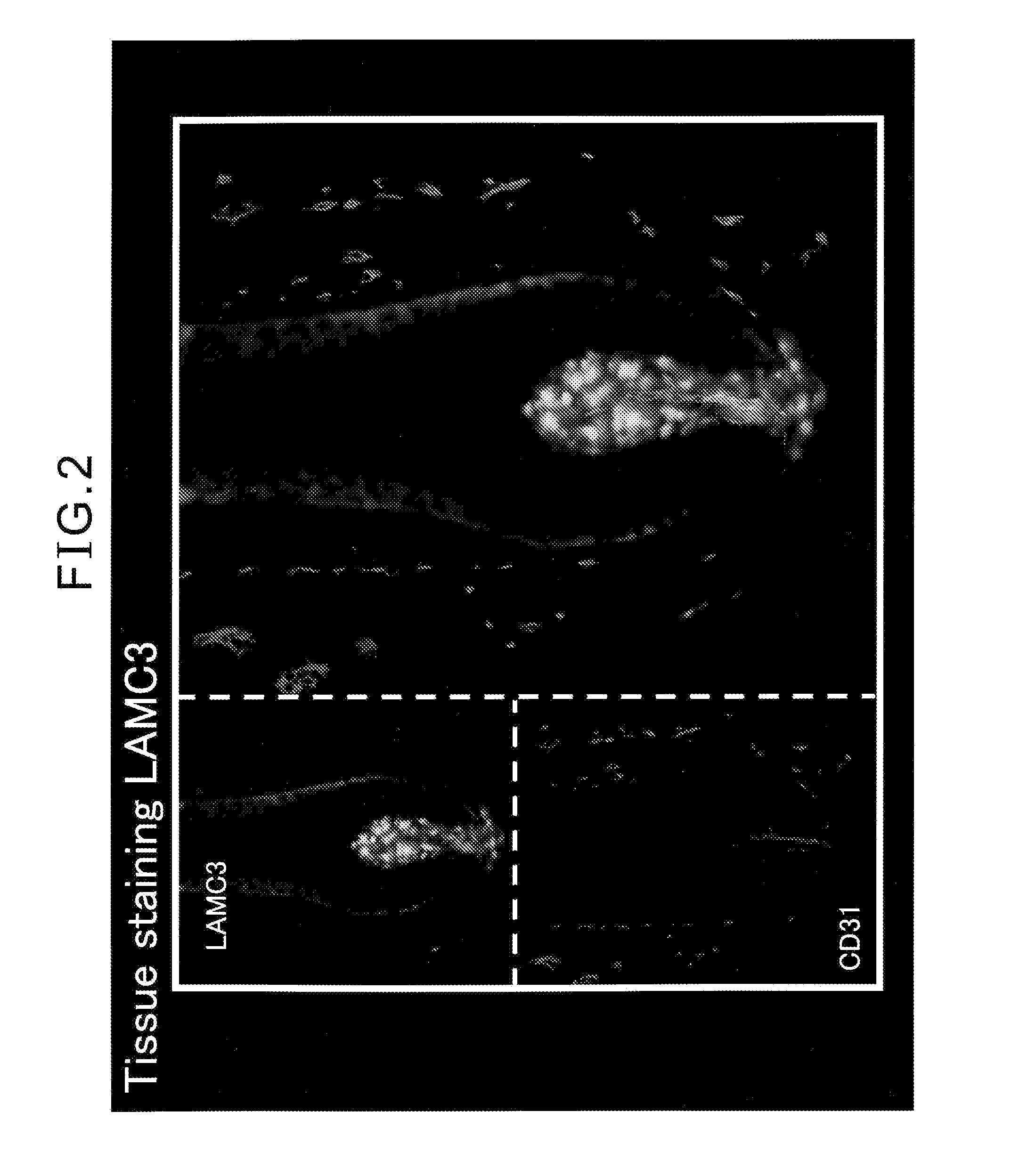 Method for promoting hair growth or hair regeneration by maintaining or increasing expression of cell-adhesion factor